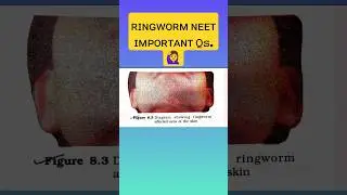 Human Health and disease😷 l NEET Biology pyqs l #short #viralshort #ytshorts #neettrack