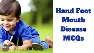 Hand Foot Mouth Disease MCQs with Rationale - Test Your Knowledge