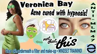 VERONICA BAY says hypnosis can cure your acne... Mindset FTW I guess | Anti-MLM (she still sucks)