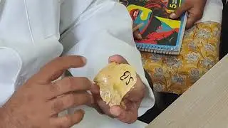 Temporal Bone (part 1) with Anatomical position
