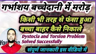 Dystocia(डिस्टोकिया)and Torsion in Cow Buffalo||गाय भैंस की डिलीवरी||फंसा हुआ बच्चा ऐसे निकाले Solve