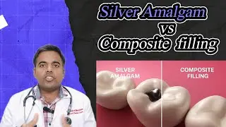 Silver Amalgam vs Composite Filling | Best Dental Filling Option Explained by Dr. Vidya Bhushan