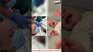 Baby born with Permanent Smile :)