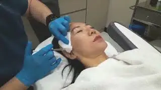 Exosomes Treatment by Professional - Step by step procedure