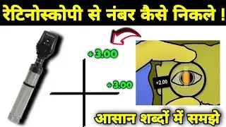 Retinoscopy se number kaise nikale/Retinoscopy, Retinoscopy in hindi, Retinoscopy for opthalmologist