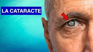 LA CATARACTE :  Explications, Causes et  Traitements