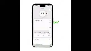 Dexcom G7 - Medication Logging in the G7 App