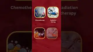 TREATMENT OPTIONS FOR LYMPHOMA
