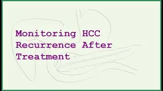 HCC After Treatment: Monitoring for Recurrence