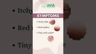 Herbs and Home Remedies for Cholinergic Urticaria Treatment #shorts