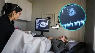 Goodbye Fertility Clinic + Hearing The Twin's Heartbeats!!!