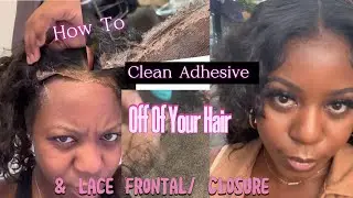How To Remove Lace Glue Off Of Your Hair & Lace Properly | WONT LOSE ANY HAIR | Quickest Way
