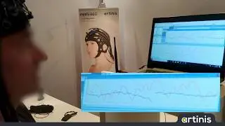 Proofing the Brite fNIRS data quality at the Organization for Human Brain Mapping (OHBM) 2019