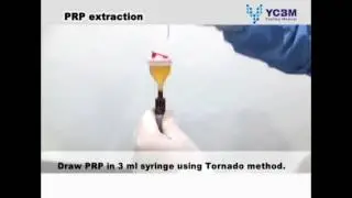 HUMEX PRP : Ycell BIO PRP