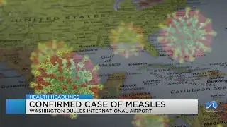 Measles case reported at Washington Dulles International Airport in Virginia