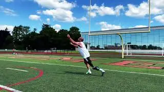 Rotationplasty Amputee | High Activity Soccer Prosthesis | #cancersurvivor