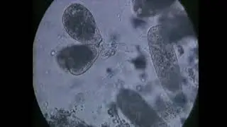 Epistylis - parasite diseases in trout - signs, identification, treatment
