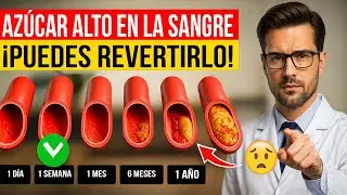 &iquest;Puedes REVERTIR la Diabetes Tipo 2 con Cambios en tu Dieta?