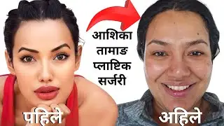 Ashika Tamang : Plastic (Cosmetic) Surgery