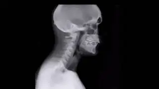 human head xray work video #viral #video