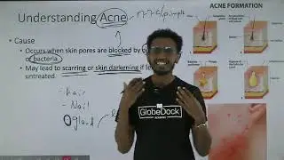 Grade 8 General science unit 4 _ 4.1.3 Major skin Disease and disorders part 2