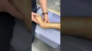 Деформация стопы