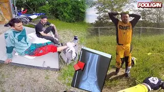 Broken Leg at Bluff Creek OHV
