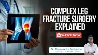 From Accident to Recovery | Open Tibia & Fibula Fracture Surgery Explained | Dr. Paneendra