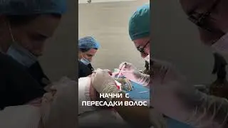 Пересадка волос: быстрый и качественный результат