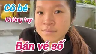Hoàng cảnh đáng thương cô bé không tay. 