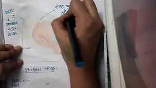 oxygen hood ||  Pediatrics