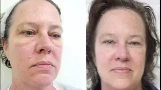 Year apart Angelic Lift results
