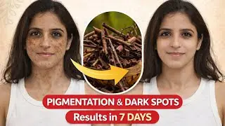 Pigmentation or Dark spots pareshaan ho? 🤔