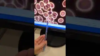 Parasites and worms can also be found inside the cells! Have you had a #livebloodcellanalysis?