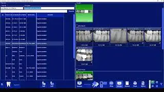 DentiView Adding Images To An Existing Layout