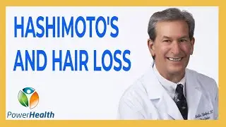 Hashimoto's and Hair Loss