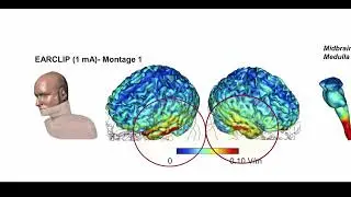 The CalmBox Brain Activation Information