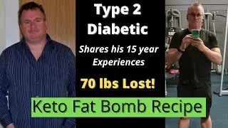 Keto Fat Bombs - 5 Delicious Keto Fat Bomb Recipes - Type 2 Diabetes Recipes.