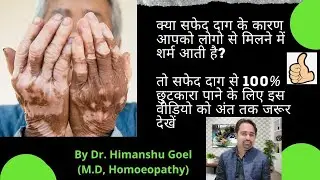 vitiligo causes and treatment | सफ़ेद दाग से छुटकारा पाने का होमियोपैथी इलाज |by dr. himanshu Goel