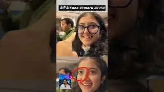 Benny ke face per mark ka Raj#viralvideo #youtubeshorts #benny