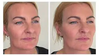 Dr Amy Clinic Video