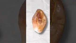 How Did Ancient Civilizations Treat Cavities?