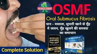OSMF MOUTH OPENING KIT | Mouth Burning Disease | मुँह खुलने मे दिक्कत का समाधान