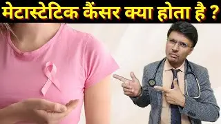 मेटास्टेटिक कैंसर क्या होता है ? / METASTATIC CANCER MEANING