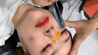 ASMR Rare Razor | Remove dead skin from an oriental woman's face.
