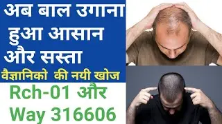 way 316606 vs Rch 01 || How to Regrow Hair Naturally || way 316606 , Rch 01 update