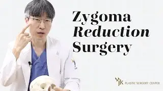 The Cheekbone Area a Plastic Surgeon with 20+ Years of Experience will NEVER operate on?! ft. Dr Kim