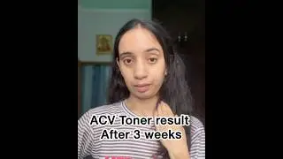&ldquo;ACV Toner for Skin: 3 Weeks of Use + What Changed&rdquo;