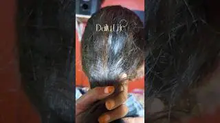 &ldquo;Best Hair Mask from Hibiscus Leaves 🌺! Stop Hair Fall & Boost Hair Growth Naturally&rdquo;#hairmask#tips