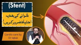 stent lagny k bad ehtiat | precautions after stent procedure | lifestyle after stent